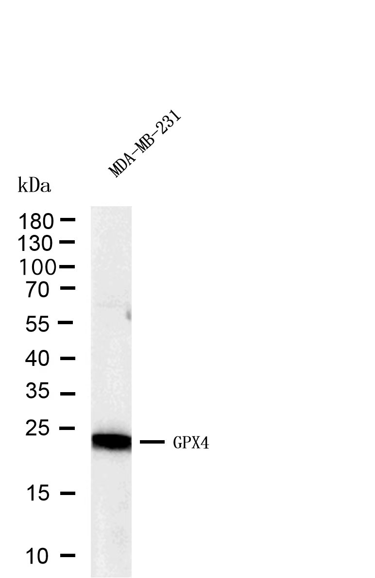 GPX4 (R635P) Rabbit mAb