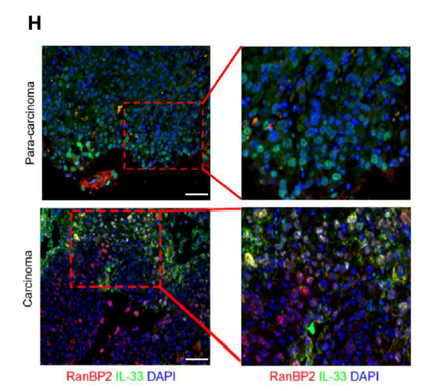 Mouse/Rabbit Tri-Labeling Four-Color Fluorescence Detection Kit